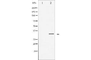Western blot analysis of C/EBP-beta expression in NIH-3T3 whole cell lysates,The lane on the left is treated with the antigen-specific peptide. (CEBPB 抗体  (Internal Region))