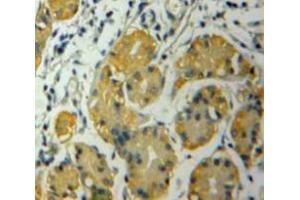 Used in DAB staining on fromalin fixed paraffin-embedded Stomach tissue (CSNK1A1 抗体  (AA 130-337))