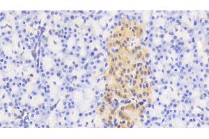 Detection of NAGa in Human Pancreas Tissue using Polyclonal Antibody to N-Acetylgalactosaminidase Alpha (NAGa)