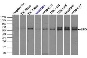 Image no. 4 for anti-Lipase, Endothelial (LIPG) antibody (ABIN1499177) (LIPG 抗体)