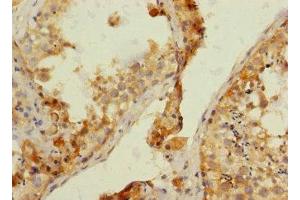 Immunohistochemistry of paraffin-embedded human testis tissue using ABIN7161917 at dilution of 1:100 (NRBP1 抗体  (AA 406-535))