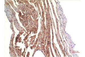 Immunohistochemical analysis of paraffin-embedded Rat Heart Tissue using VE-Cadherin Mouse mAb diluted at 1:200. (Cadherin 5 抗体  (AA 670-750))