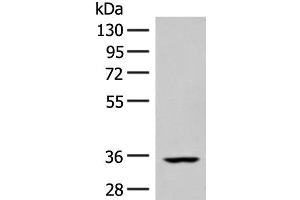 Western blot analysis of Human heart tissue lysate using FBXO16 Polyclonal Antibody at dilution of 1:400 (FBXO16 抗体)