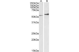 ABIN2613493 (0. (Vimentin 抗体  (C-Term))