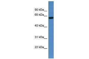 Western Blot showing TCHP antibody used at a concentration of 1-2 ug/ml to detect its target protein. (TCHP 抗体  (C-Term))