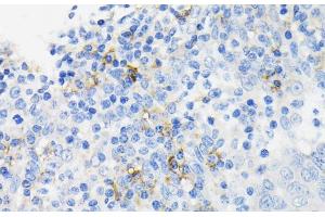 Immunohistochemistry of paraffin-embedded Human tonsil using CAMP Polyclonal Antibody at dilution of 1:200 (40x lens). (Cathelicidin 抗体)