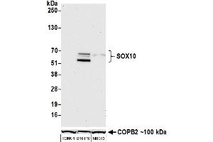 Western Blotting (WB) image for anti-SRY (Sex Determining Region Y)-Box 10 (SOX10) (AA 416-466) antibody (ABIN7455186) (SOX10 抗体  (AA 416-466))