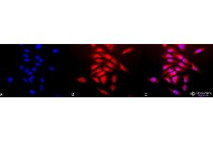 Immunocytochemistry/Immunofluorescence analysis using Rabbit Anti-SOD (Cu/Zn) Polyclonal Antibody . (SOD1 抗体  (PerCP))