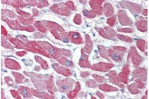 Heart, Human: Formalin-Fixed, Paraffin-Embedded (FFPE) (CRYAB 抗体)