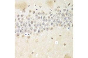 Immunohistochemistry (Paraffin-embedded Sections) (IHC (p)) image for anti-Non-POU Domain Containing, Octamer-Binding (NONO) (AA 1-300) antibody (ABIN6144713)