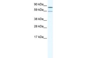 Western Blotting (WB) image for anti-Poly A Specific Ribonuclease (PARN) antibody (ABIN2461521)