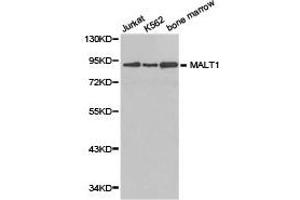 Western Blotting (WB) image for anti-Mucosa Associated Lymphoid Tissue Lymphoma Translocation Gene 1 (MALT1) antibody (ABIN1873591)