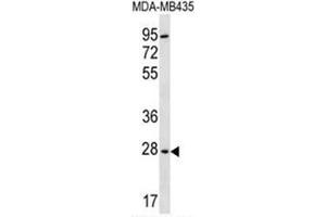 BPGM Antibody (C-term) western blot analysis in MDA-MB435 cell line lysates (35µg/lane). (BPGM 抗体  (C-Term))