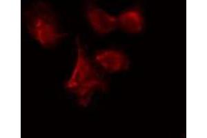 ABIN6274085 staining Hela cells by IF/ICC. (CDC7 抗体  (N-Term))