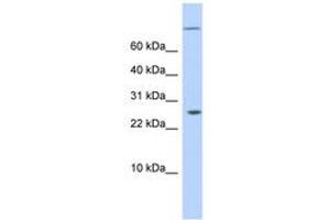 Image no. 1 for anti-AT Rich Interactive Domain 5A (MRF1-Like) (ARID5A) (N-Term) antibody (ABIN6743583) (ARID5A 抗体  (N-Term))