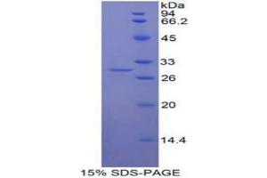 SDS-PAGE analysis of Human Mindbomb Homolog 2 Protein. (MIB2 蛋白)