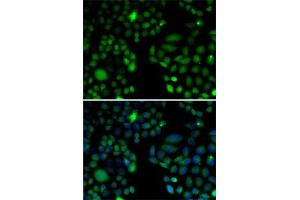 Immunofluorescence analysis of U2OS cells using EPC1 antibody (ABIN6133506, ABIN6140203, ABIN6140204 and ABIN6221494). (EPC1 抗体  (AA 1-300))