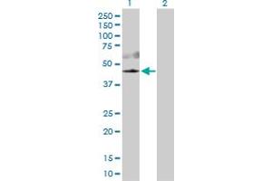 Western Blot analysis of AKT3 expression in transfected 293T cell line by AKT3 MaxPab polyclonal antibody. (AKT3 抗体  (AA 1-479))