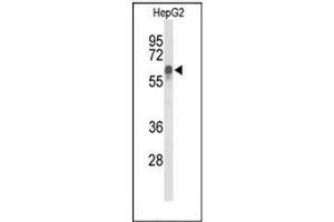 Western blot analysis of ITPKC Antibody (N-term) in HepG2 cell line lysates (35ug/lane). (ITPKC 抗体  (N-Term))