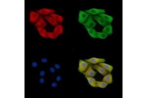 ABIN7095697 and ABIN7099759 staining Hela cells by IF/ICC.