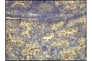 Immunohistochemistry (IHC) image for anti-Transcription Termination Factor, RNA Polymerase I (TTF1) (N-Term) antibody (ABIN870521) (TTF1 抗体  (N-Term))