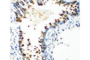 Immunohistochemistry of paraffin-embedded Rat lung using MTCO2 Polyclonal Antibody at dilution of 1:100 (40x lens). (COX2 抗体)