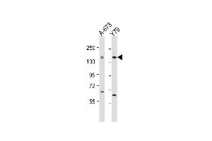All lanes : Anti-CACNA1F Antibody (Center) at 1:2000 dilution Lane 1: A-673 whole cell lysate Lane 2: Y79 whole cell lysate Lysates/proteins at 20 μg per lane. (CACNA1F 抗体  (AA 743-776))