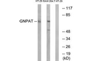 Western Blotting (WB) image for anti-Glyceronephosphate O-Acyltransferase (GNPAT) (AA 231-280) antibody (ABIN2890262) (GNPAT 抗体  (AA 231-280))