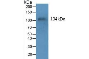 Detection of MUC1 in Human Blood Cells using Polyclonal Antibody to Mucin 1 (MUC1) (MUC1 抗体  (AA 1034-1151))