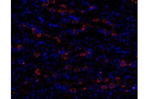 Immunohistochemistry (IHC) image for anti-Early Endosome Antigen 1 (EEA1) (AA 2-13) antibody (ABIN1742484) (EEA1 抗体  (AA 2-13))