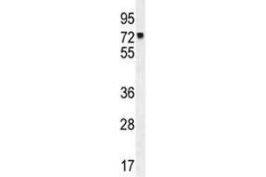 MLH1 antibody western blot analysis in K562 lysate. (MLH1 抗体  (AA 452-480))