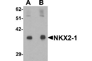 Western blot analysis of NKX2-1 in rat lung tissue lysate with NKX2-1 antibody at (A) 1 and (B) 2 µg/mL. (NKX2-1 抗体  (N-Term))