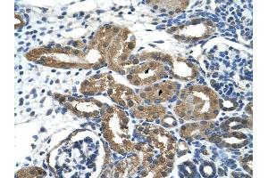 HDAC9 antibody was used for immunohistochemistry at a concentration of 2. (HDAC9 抗体  (C-Term))