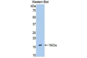 Western Blotting (WB) image for anti-Endoglin (ENG) (AA 26-136) antibody (ABIN1858716) (Endoglin 抗体  (AA 26-136))
