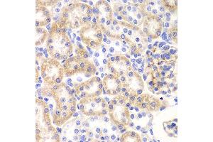 Immunohistochemistry of paraffin-embedded rat kidney using SHMT2 antibody at dilution of 1:100 (400x lens). (SHMT2 抗体)