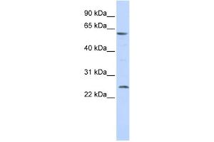 WB Suggested Anti-SLC18A1 Antibody Titration:  0. (SLC18A1 抗体  (Middle Region))