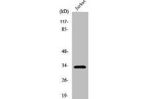 Western Blot analysis of Jurkat cells using Cleaved-Cathepsin A 32k (R326) Polyclonal Antibody (CTSA 抗体  (Cleaved-Arg326))
