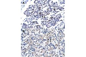 Immunohistochemical staining (Formalin-fixed paraffin-embedded sections) of human pancreas (A) and human liver (B) with CDX4 polyclonal antibody  at 4-8 ug/mL working concentration. (CDX4 抗体  (C-Term))