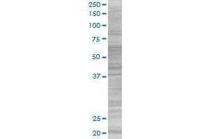 Western Blotting (WB) image for CDO1 293T Cell Transient Overexpression Lysate(Denatured) (ABIN1331320)