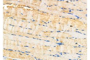 ABIN6264868 and ABIN6277492 at 1/100 staining Rat muscle tissue by IHC-P. (RRM2 抗体  (C-Term))