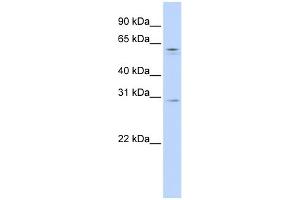 WB Suggested Anti-REC8 Antibody Titration:  0. (REC8 抗体  (N-Term))