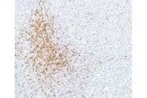 Immunohistochemistry (IHC) image for anti-CD5 (CD5) (AA 25-371) antibody (ABIN7449418) (Recombinant CD5 抗体  (AA 25-371))