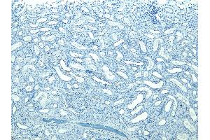 (ABIN184697) Negative Control showing staining of paraffin embedded Human Kidney, with no primary antibody. (STUB1 抗体  (C-Term))