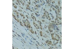 Immunohistochemistry (IHC) image for anti-GA Binding Protein Transcription Factor, alpha Subunit 60kDa (GABPA) (AA 1-260) antibody (ABIN6140889)