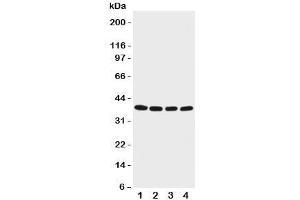 Western blot testing of EIF2B antibody and Lane 1:  M451;  2: Jurkat;  3: HeLa;  4: 293T cell lysate. (EIF2S2 抗体  (C-Term))