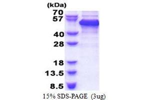 SDS-PAGE (SDS) image for RNA Binding Motif Protein 17 (RBM17) (AA 1-401) protein (His tag) (ABIN5853401) (RBM17 Protein (AA 1-401) (His tag))