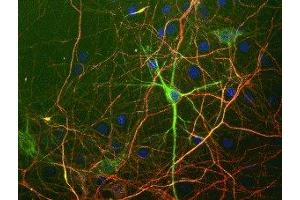 Immunostaining (ISt) image for anti-Neurofilament, Heavy Polypeptide (NEFH) antibody (ABIN361351)