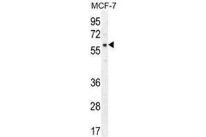 AKT1 Antibody (pT450) western blot analysis in MCF-7 cell line lysates (35 µg/lane). (AKT1 抗体  (C-Term))