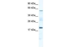 CSNK1G1 antibody (20R-1168) used at 0. (CSNK1G1 抗体  (Middle Region))