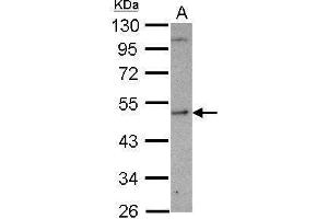 WB Image Sample (30 ug of whole cell lysate) A: U87-MG 10% SDS PAGE antibody diluted at 1:1000 (SHMT1 抗体)